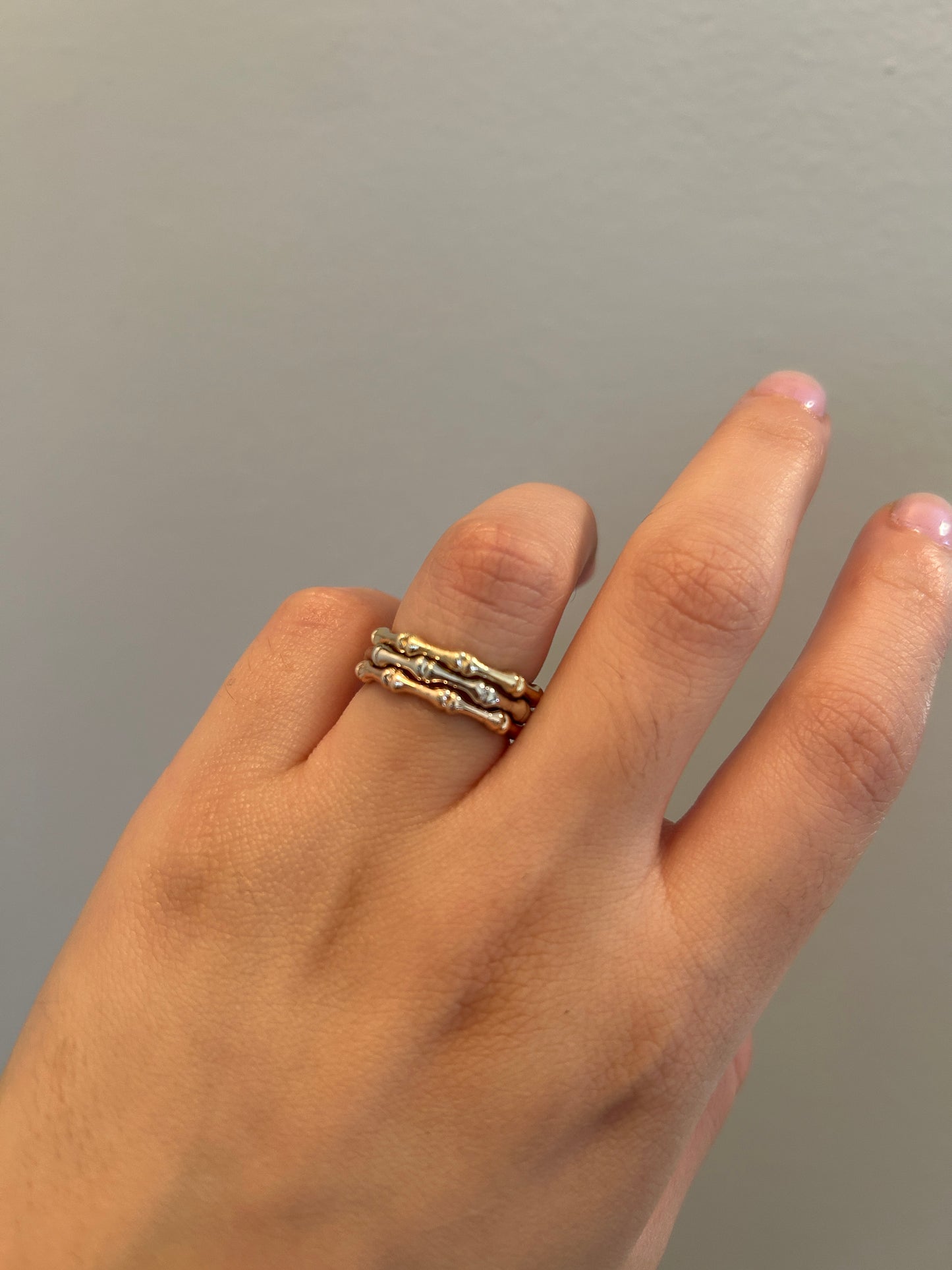 Bones in the forest ring